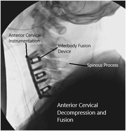 Intraoperative fluoroscopic images 2 Intraoperative fluoroscopic images 2