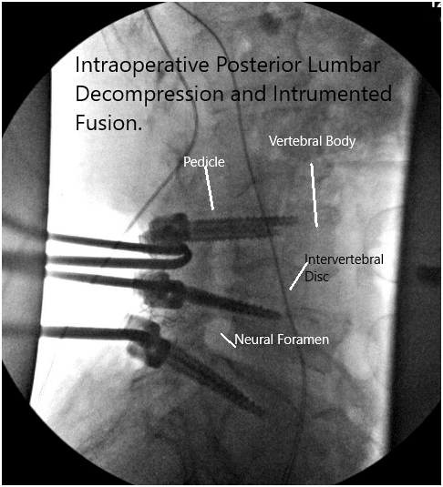 Imágenes de fluoroscopia intraoperatoria 2