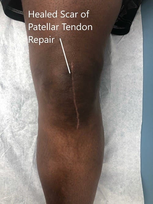 Postoperative images at 2 months follow up.