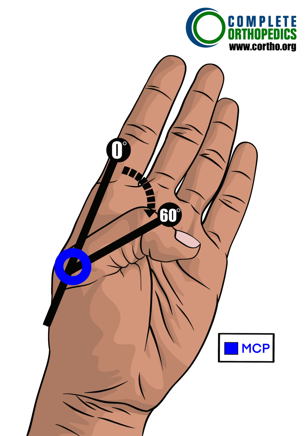 articulación metacarpopalángica del pulgar para evaluar la pérdida de movimiento y calcular la pérdida de uso programada para pacientes de compensación laboral