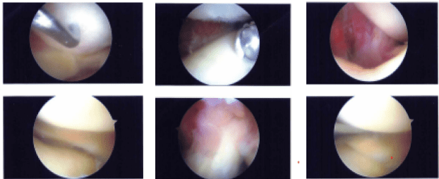 Intraoperative Images