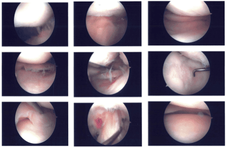 Imágenes intraoperatorias