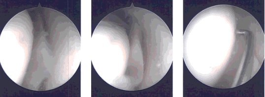 Intraoperative images