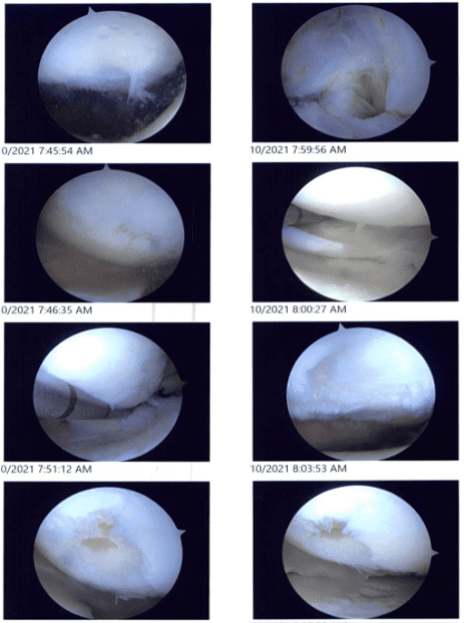 Imágenes intraoperatorias