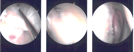 Intraoperative images