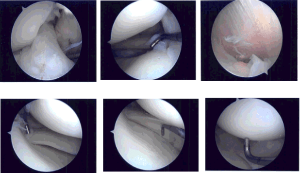 Intraoperative photo